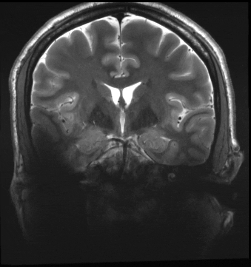 a gif of an MRI